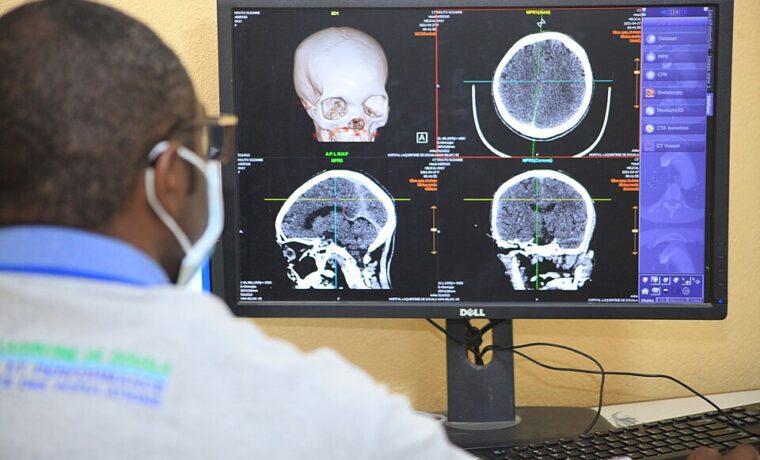 Radiolog przy komputerze z obrazami diagnostycznymi w szpitalu Laquintinie w Douali, Kamerun, w 2021 roku. Ilustracja informatyki medycznej, nie wdrożenia CeZ.