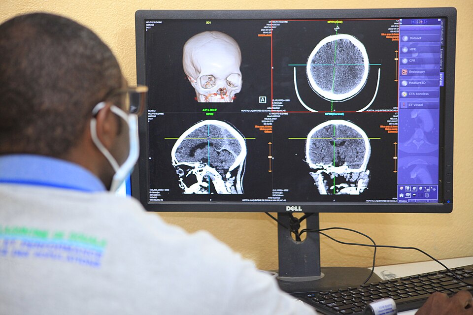 Radiolog przy komputerze z obrazami diagnostycznymi w szpitalu Laquintinie w Douali, Kamerun, w 2021 roku. Ilustracja informatyki medycznej, nie wdrożenia CeZ.