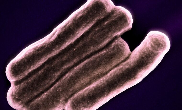 Barwiony obraz z mikroskopu elektronowego prątków Mycobacterium tuberculosis. Fotografia NIAID z 2023 roku.