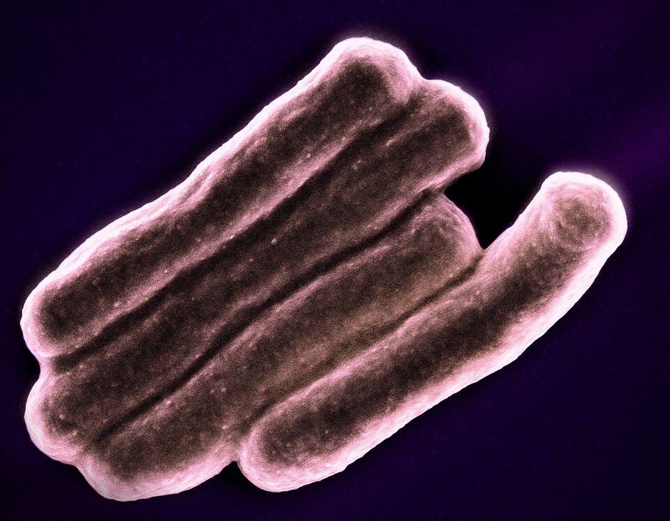 Barwiony obraz z mikroskopu elektronowego prątków Mycobacterium tuberculosis. Fotografia NIAID z 2023 roku.